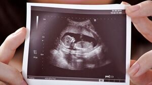 سقط جنین اینترنتی با ۴ میلیون تومان!